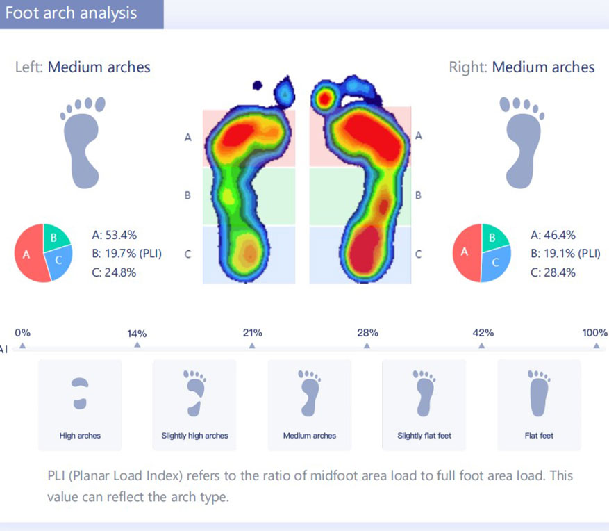 Plantardruckanalyse einschließlich: